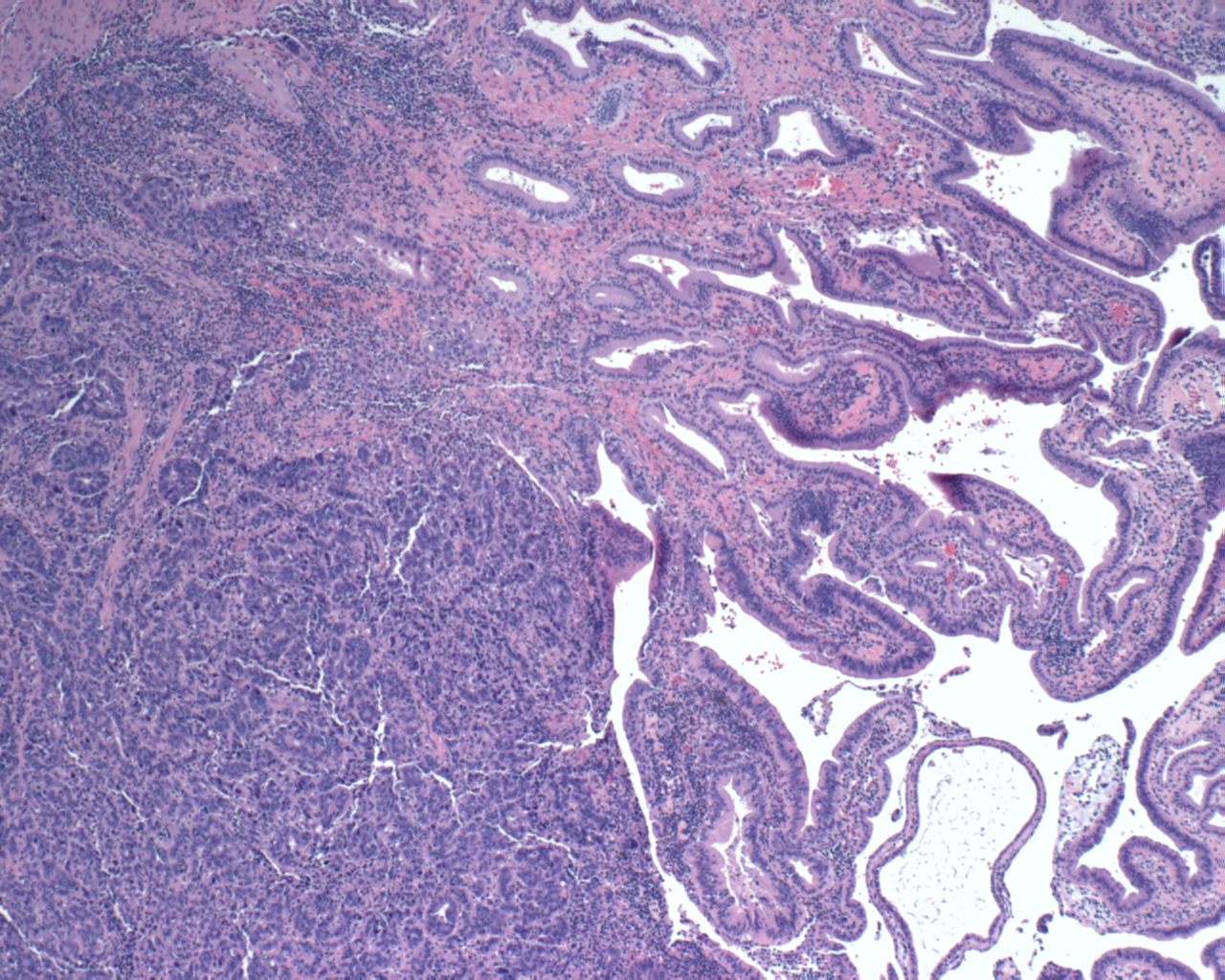 Pathology Image